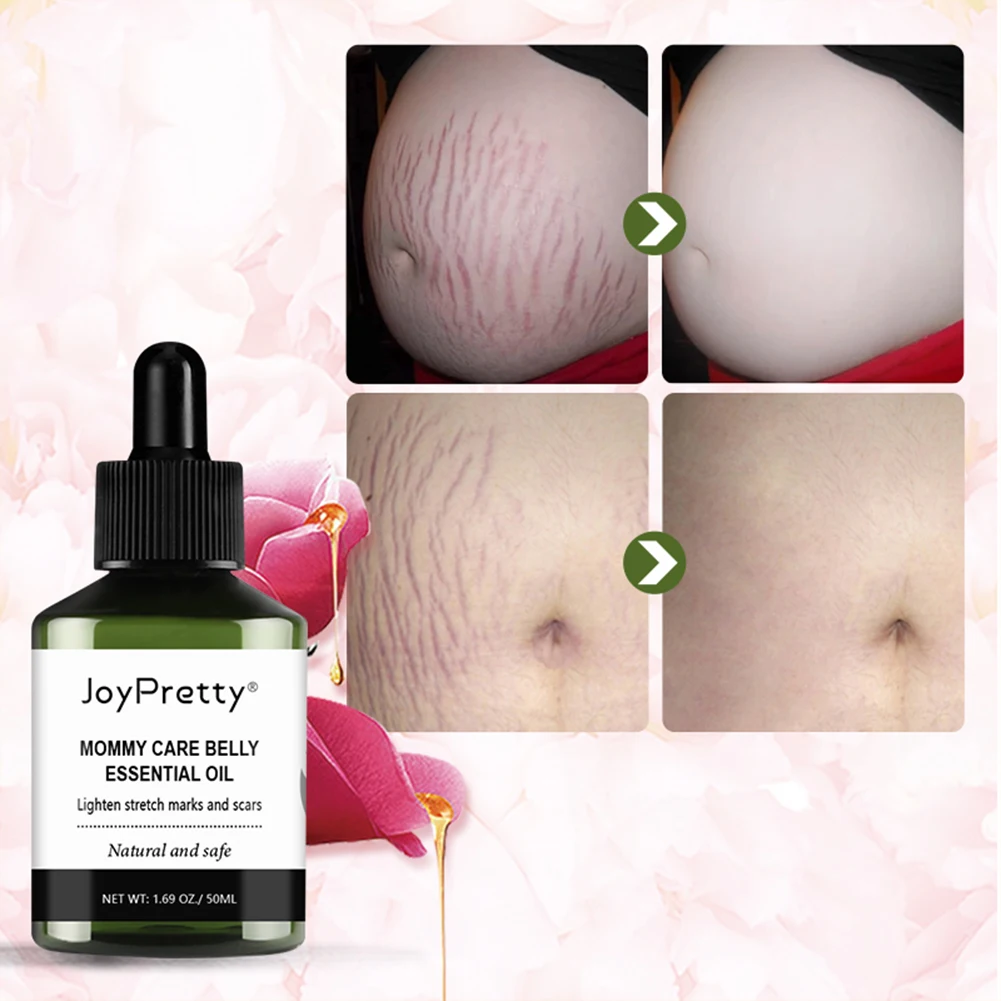 

Stretch Marks Remover Essential Oil Skin Care Treatment Cream For Stretch Mark Removal Maternity Slackline For Pregnant Oils