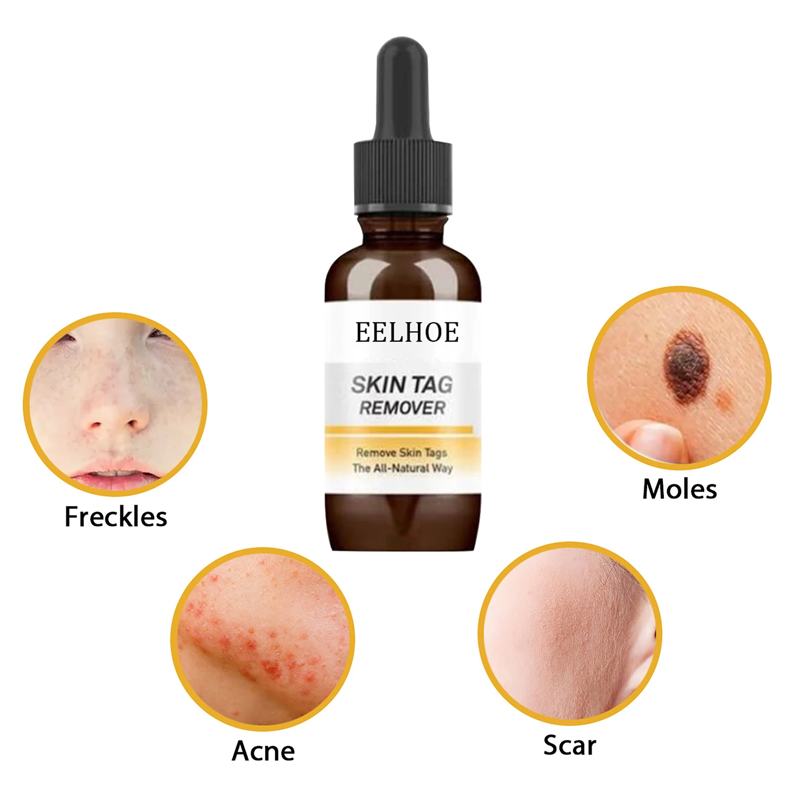 

30MLWart Treatment Papillomas Removal Of Warts Liquid From Skin Tags Removing Liquid Against Moles Remover