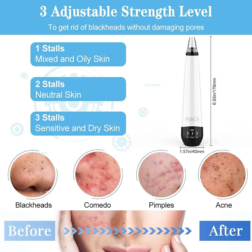 Вакуумное устройство для удаления черных точек на лице инструмент очистки пор и