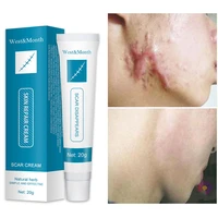 acne scar removal cream repair burn surgical scars stretch marks %e2%80%8bpromote cell regeneration enhance smoothing body skin care 20g