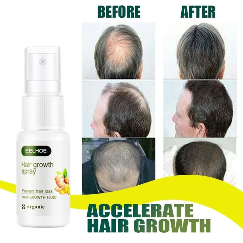 

20ml Ginger Hair Growth Spray Prevent Hair Loss Hair Oil Essential Hair Repair Liquid Growth Loss Hair Products Z5A6