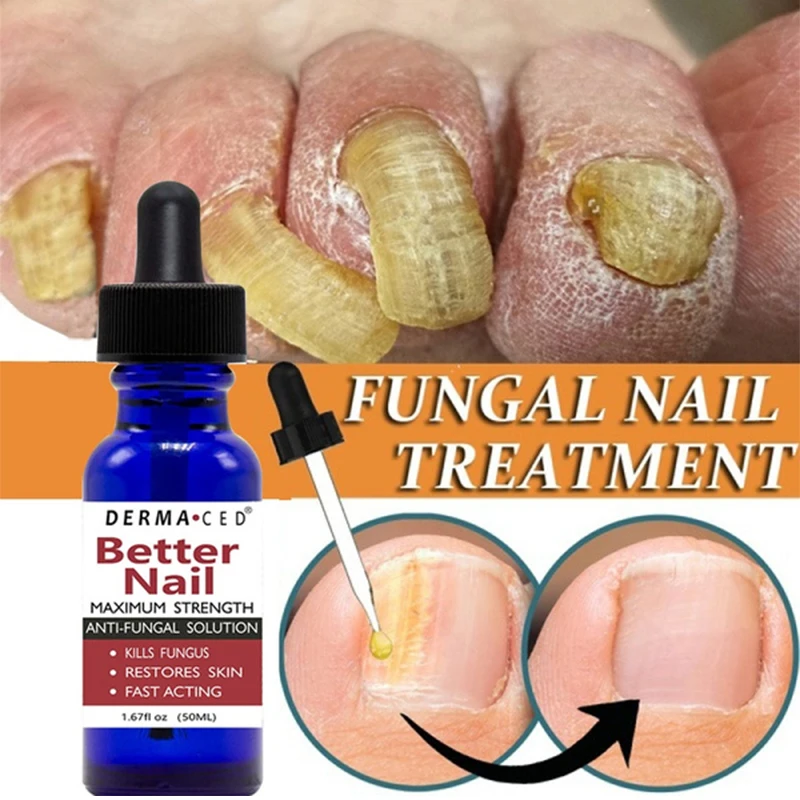 

Сыворотка для восстановления ногтей, 30 мл