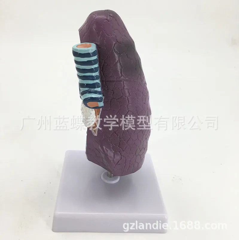 Медицинская модель медицинской анатомической патологии дыхания и легких| |