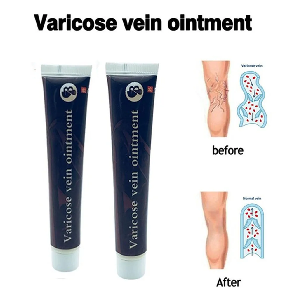 Крем для лечения варикозного расширения вен эффективное лечение васкулита