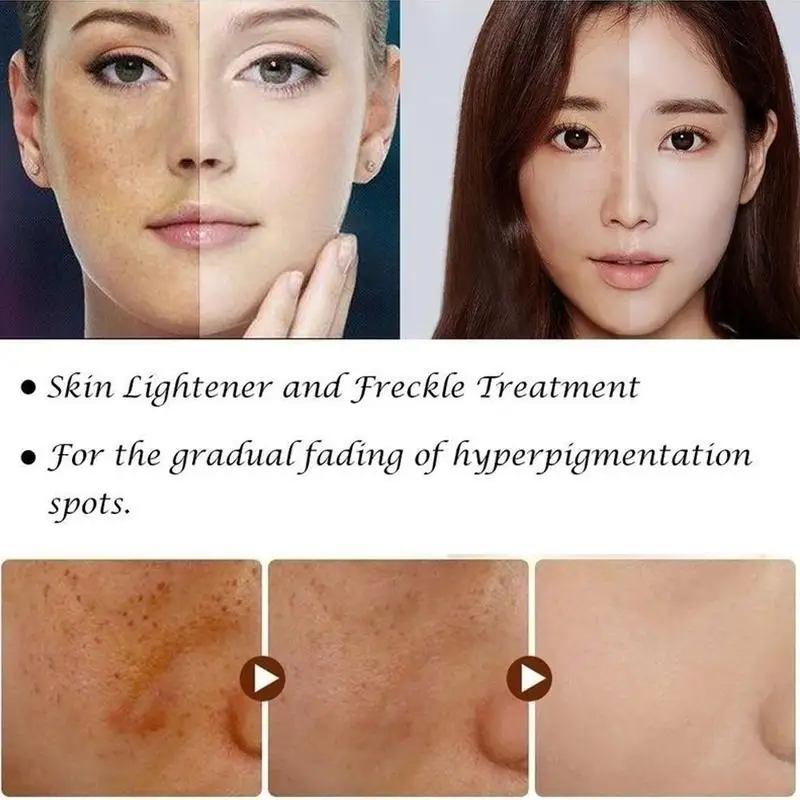 Мощный отбеливающий крем для тела увлажняющий ухода за кожей лосьон мгновенного