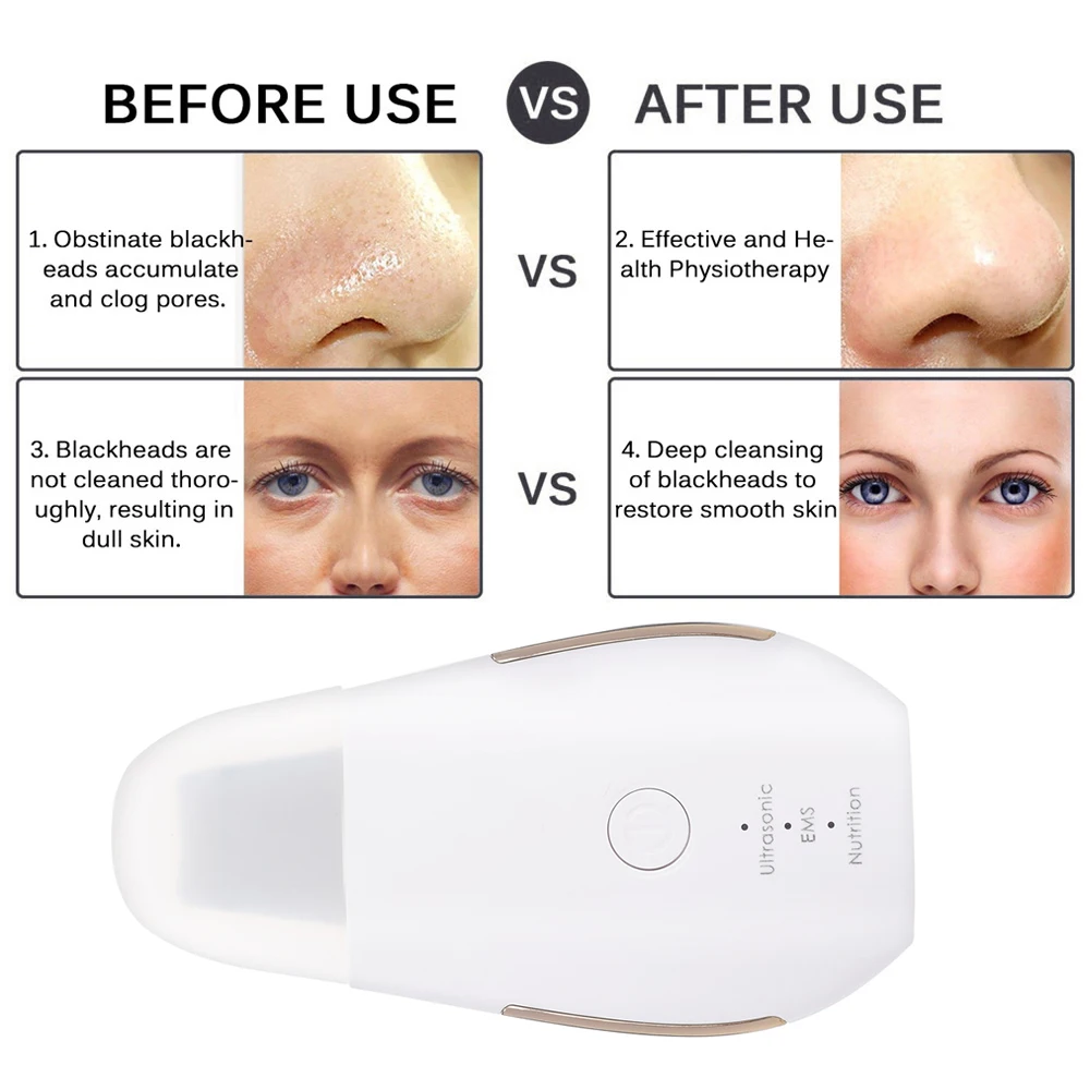 

New Rechargeable Ultrasonic Face Skin Scrubber Facial Cleaner Peeling Vibration Blackhead Removal Exfoliating Pore Cleaner Tools