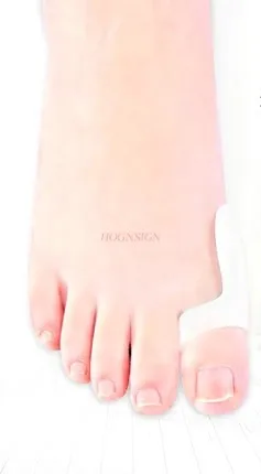 Устройство для ухода за вальгусной деформацией большая стопа защита от костей