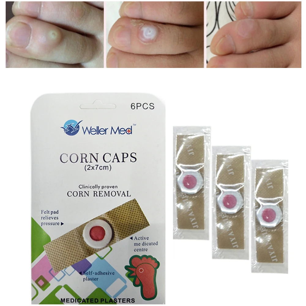 24 шт./лот ручная ножка кукуруза кокон наклейка традиционная медицинская для