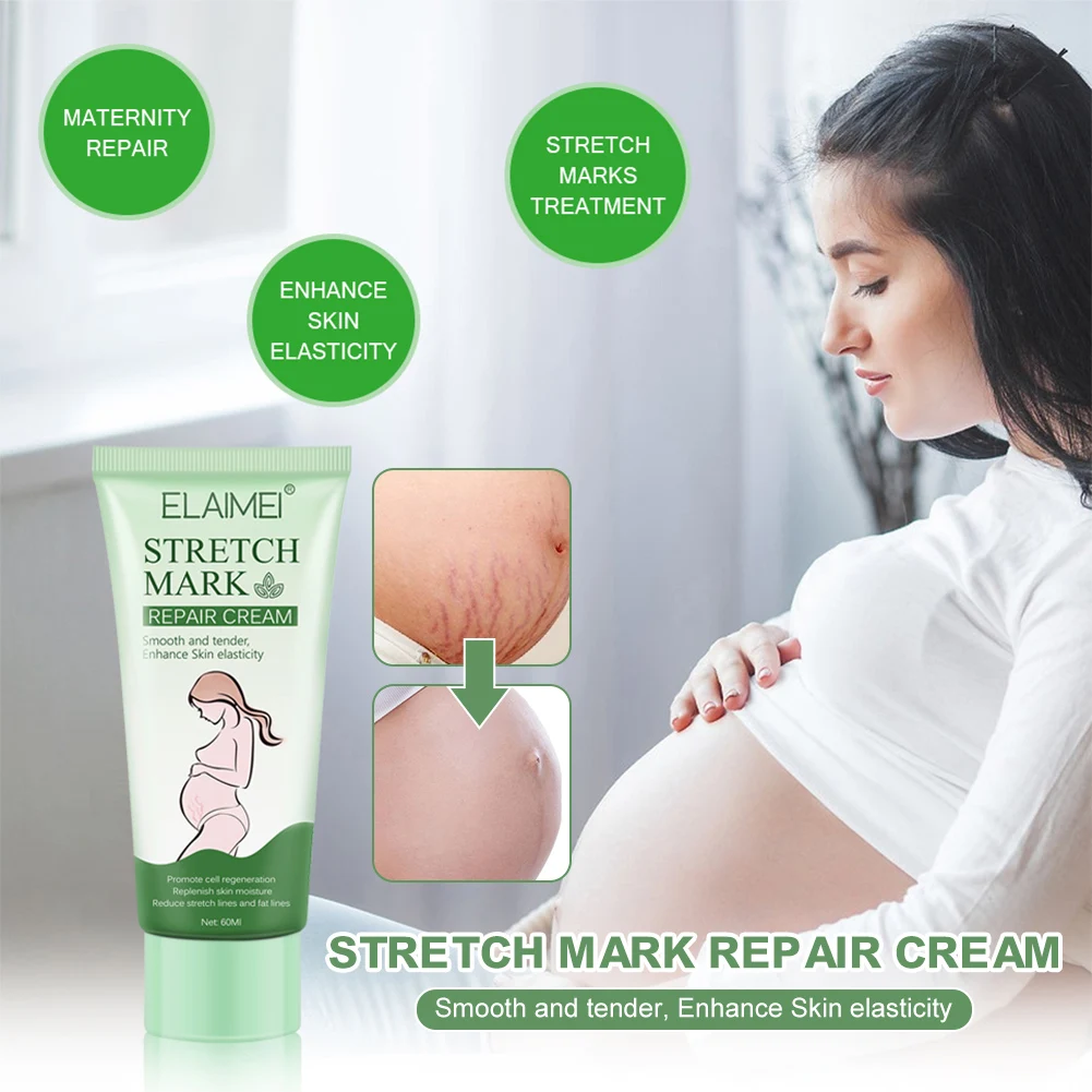 

Postpartum Pregnancy Wrinkles 60g Desalination Repair Cream Reduce Obesity Wrinkles Smooth And Delicate Enhance Skin Elasticity