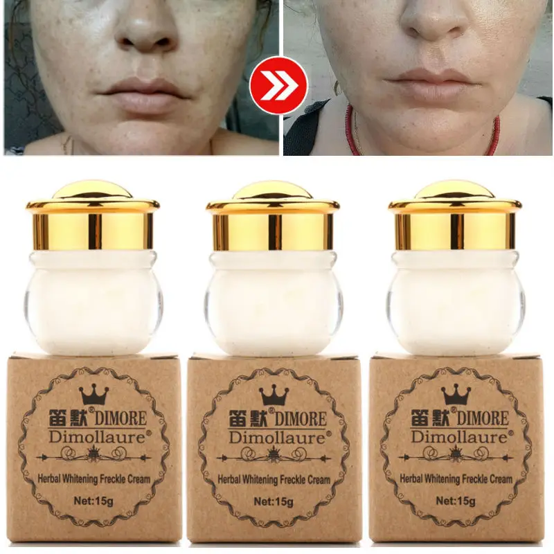 Dimollaure лица отбеливающий крем удалить меланодермия веснушки спекл загар пятна