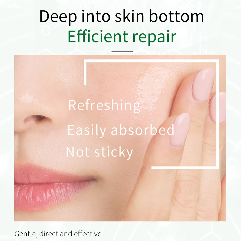 

Female Face Anti-acne Repair Serum Moisturizes Sensitive Care Facial Essence After Sun Anti-inflammatory Face Care