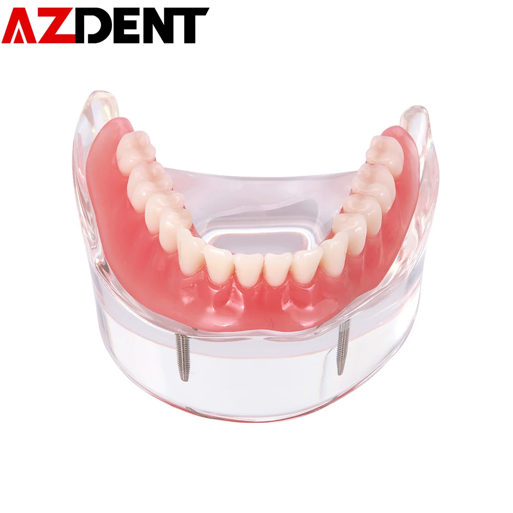 Модель зубного протеза съемная внутренняя модель нижних зубов Mandibular с