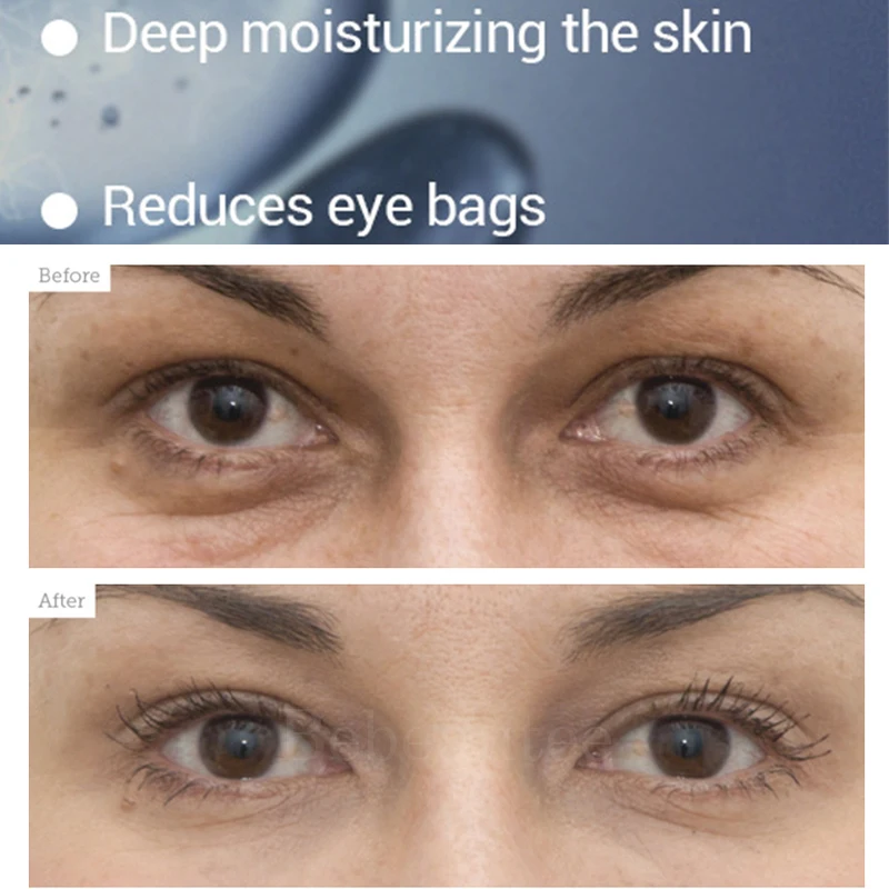 Патчи Lambena для глаз маски Lanbena Retinol против морщин с гиалуроновой кислотой