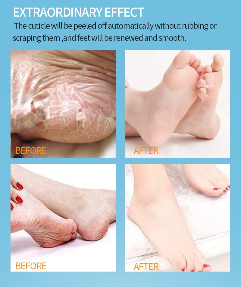 

10Pair Exfoliating Foot Mask Skin Care Peeling Dead Skin Feet Mask Pedicure Socks Foot Cream for Heels Exfoliation for Feet Mask