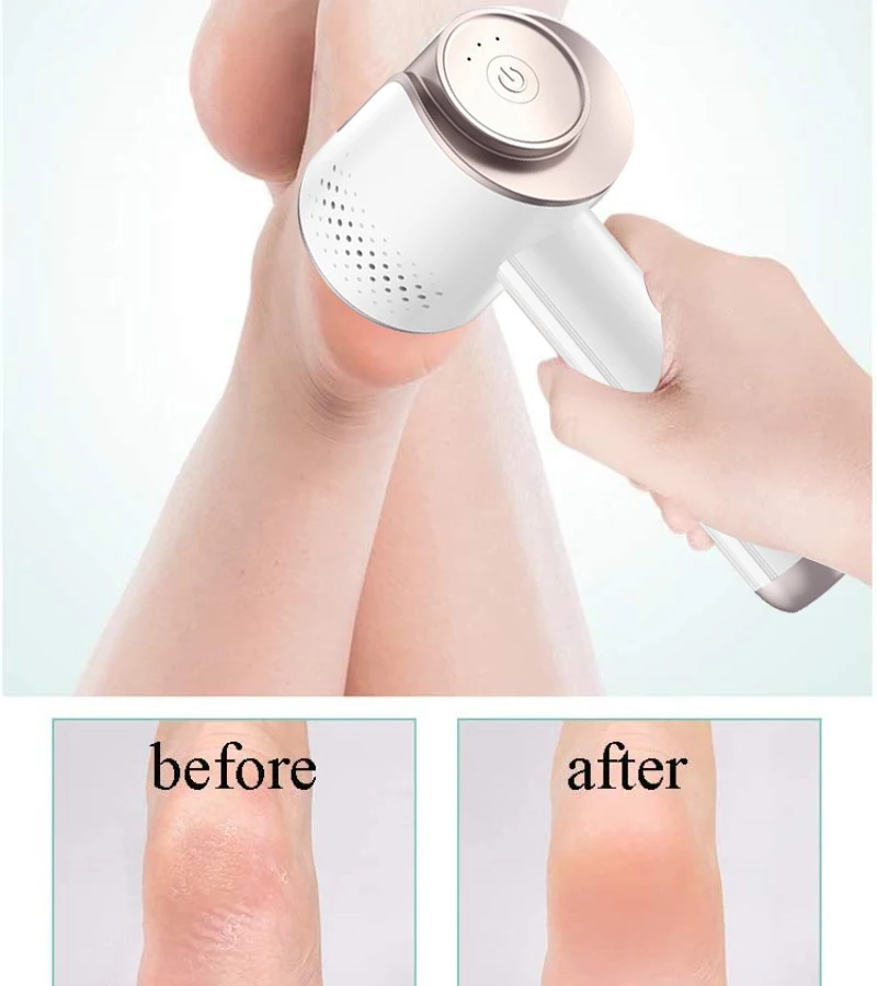 Newest Electric Foot Grinder Vacuum Callus Remover Pedicure Tools Rechargeable Files Clean for Hard Cracked Skin |