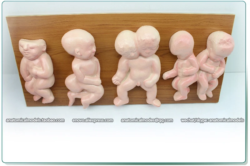 CMAM/12452 патологическая модель плода мочеполового и медицинского обучения