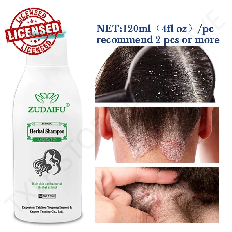Prurido e Descamação Psoríase do Couro Cabeludo e Dermatite Zudaifu Tratamento Terapêutico Shampoo Anti-caspa Seborreica 120ml – 300ml