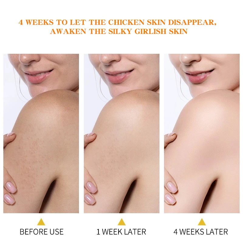 

Hemeiel Whitening Cream for Underarm Leg skin Dark Black Lightening Moisturizing Skin Intimate Body Lotion Skin Care