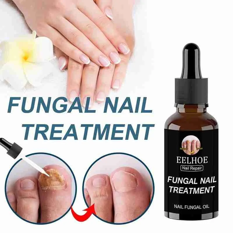 

Remove Onychomycosis Solution Foot Anti-fungal Nail Care Repair Liquid Feet Healthy Paronychia Fungal Nails Treatment Care Serum