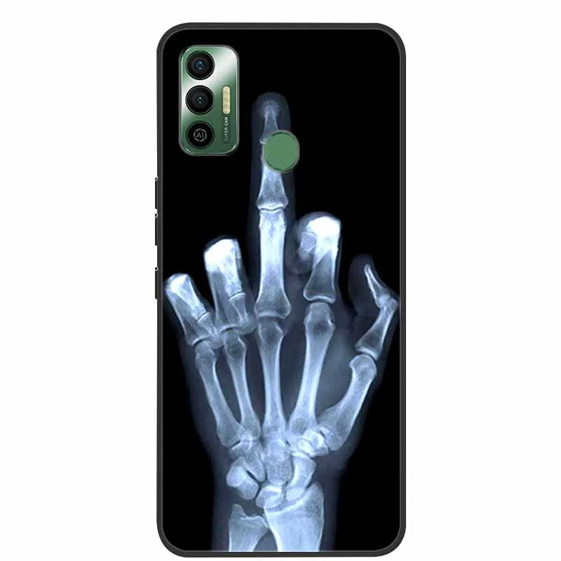 For Tecno Spark 7 Case Shockproof Soft silicone TPU Back Cover For Tecno Spark 7 6.5