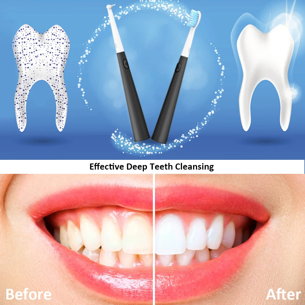 

Electric Ultrasonic Sonic Dental Scaler Tooth Calculus Remover Cleaner Tooth Stains Tartar Tool Whiten Teeth Tartar Remove