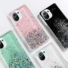 Роскошный блестящий чехол для телефона xiaomi mi 10 10T 10S 11 11pro 11 pro lite 5G, задняя крышка для xiaomi mi11, прозрачный чехол из ТПУ