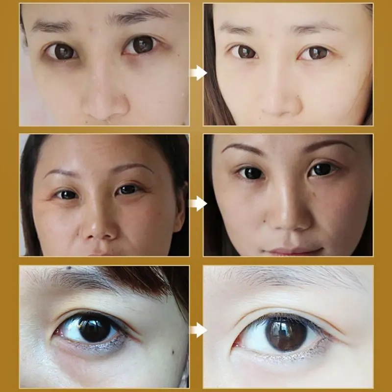 

Roll-on Eye Cream Moisturizer Anti-Dark Circle Wrinkle Firming Maquiagem Moisturizing Fashion Make Up Maquillaje Beauty