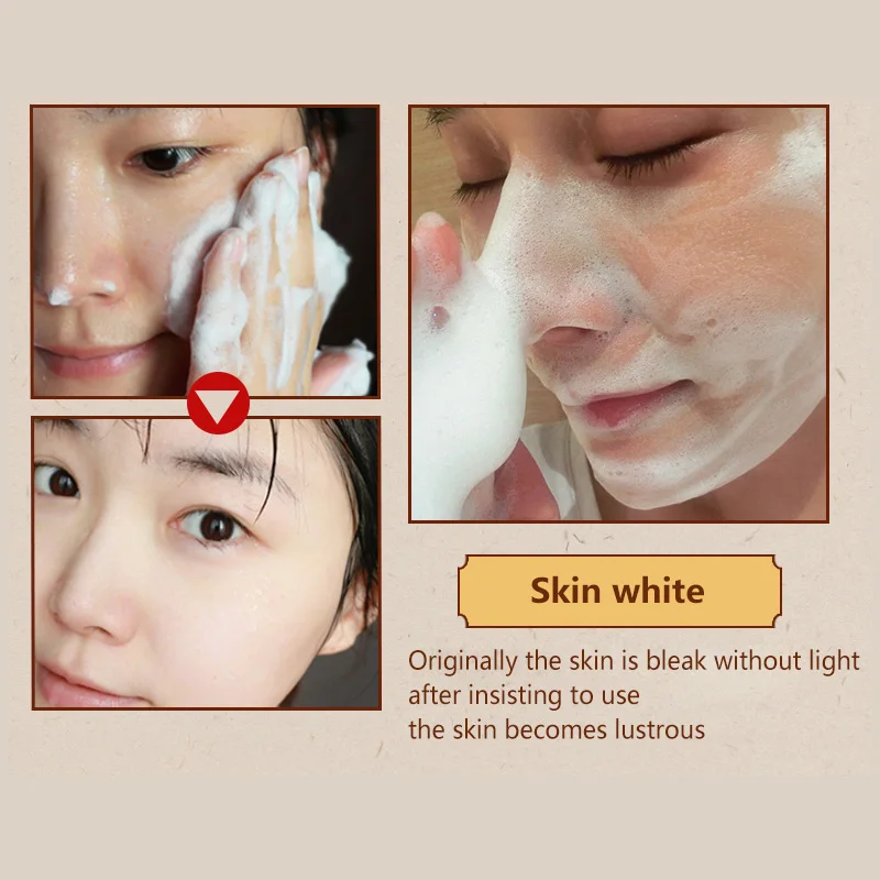 WXE 80 г Очиститель Удаление прыщей поры лечение акне увлажнение уход за лицом