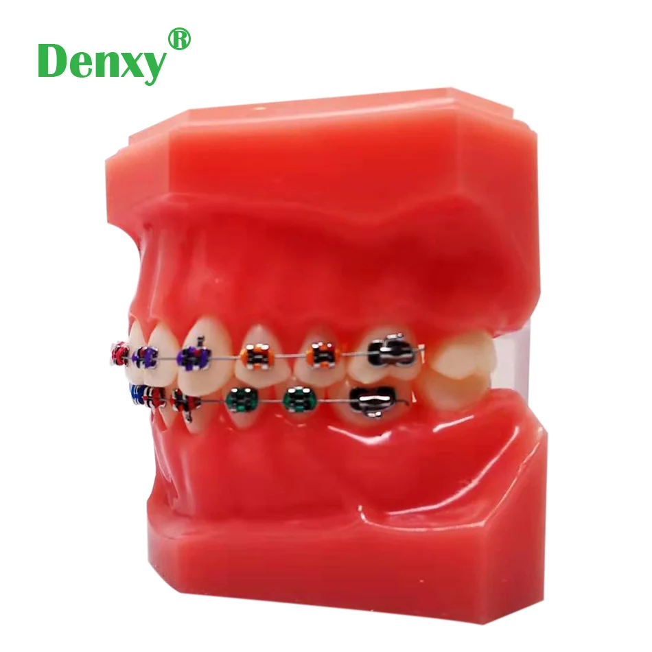 Стоматологическая Ортодонтическая модель Denxy с ортодонтическим металлическим