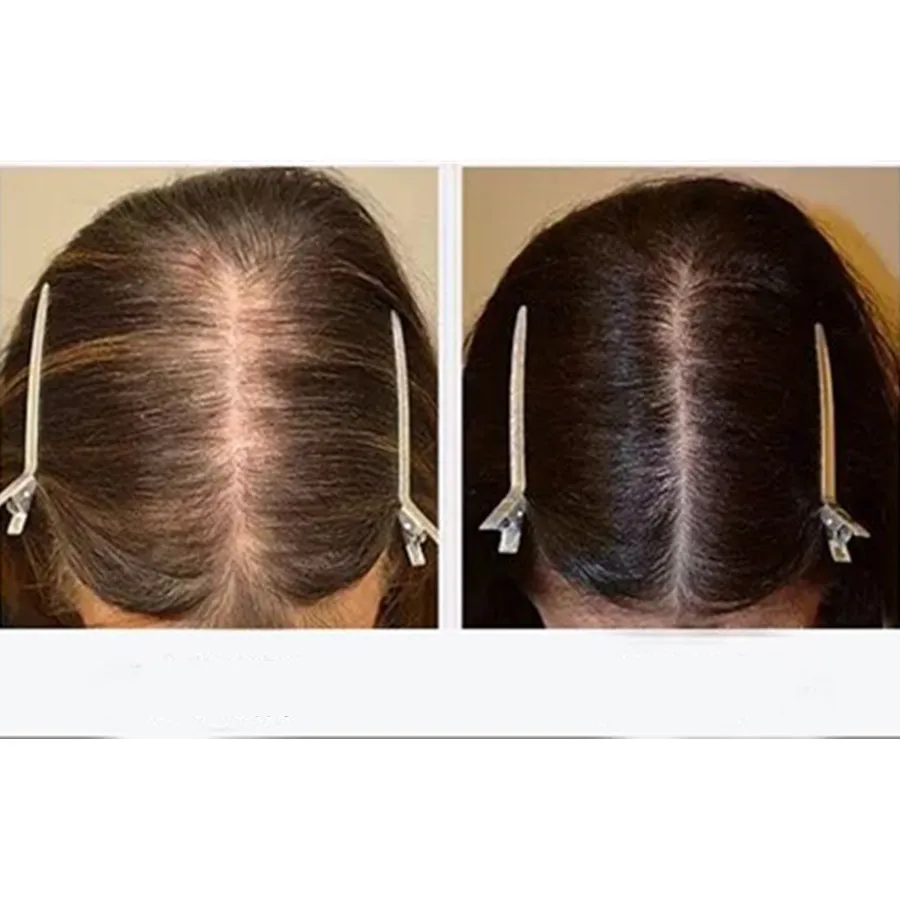 массаж головы для роста волос схема. точки массажа головы для роста волос. массаж головы схема самомассаж. самомассаж волосистой части головы для роста волос. массаж волосистой части головы схемы.