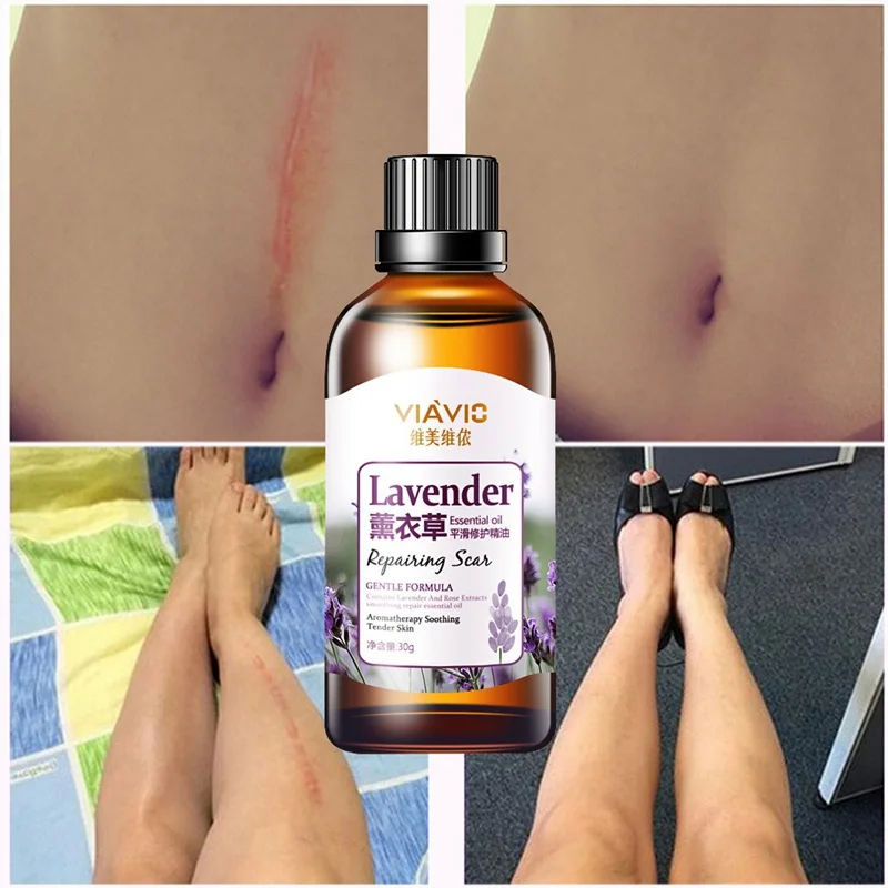 Эфирное масло лаванды для восстановления рубцов 30 г | Красота и здоровье