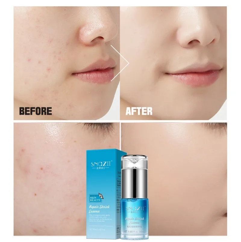 Яркие Гламурные для лица с гиалуроновой кислотой Сыворотка против старения