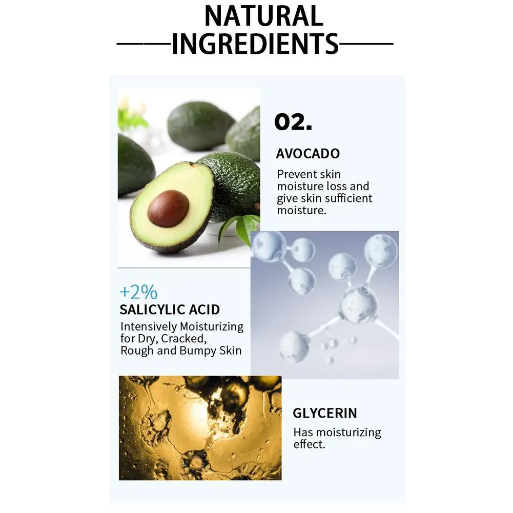 

Foot Moisturizing Care Cream Anti-drying, Cracking And Rough Improving Chicken Skin Foot Care Cream