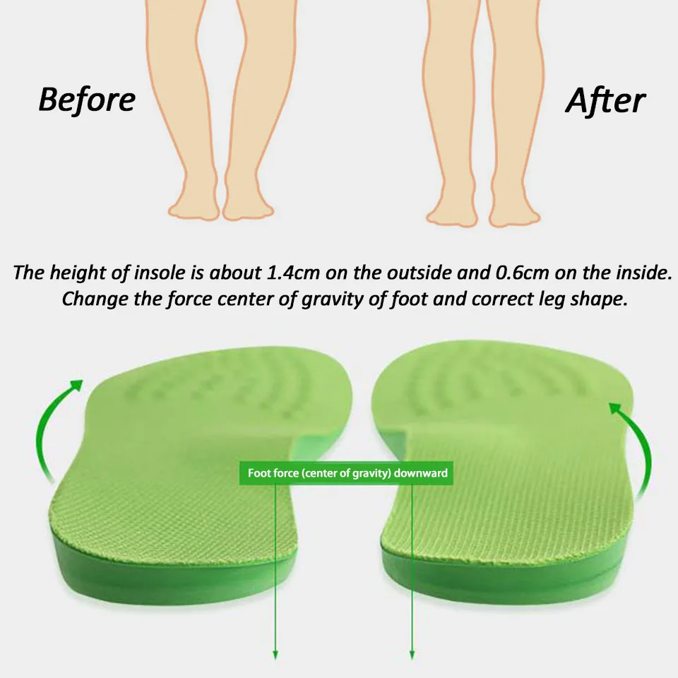 Фото Ортопедические стельки UPMAKE O/X-Leg поддержка свода стопы коржеточный бант Ортопедические стельки UPMAKE O/X-Leg поддержка свода стопы коржеточный бант