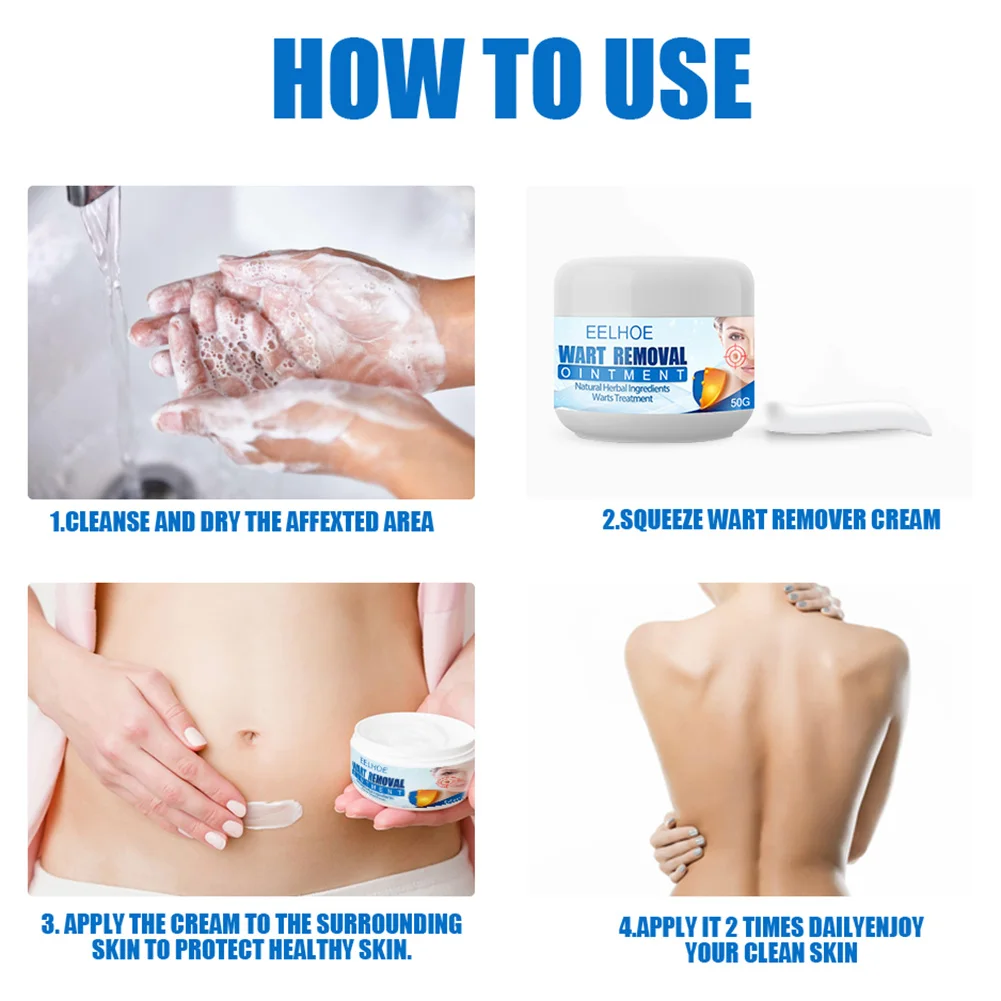 

Wart Remover Safe Painless Skin Genital Wart Treatment Medical kill Remover Skin Tag Mole Genital Wart Remover 100% All Natural