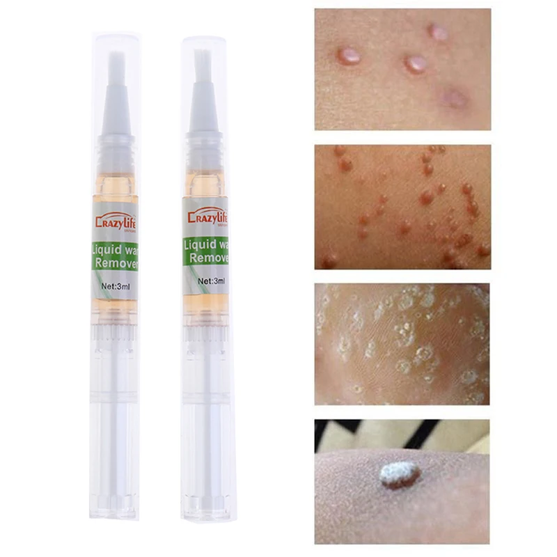 2 шт. ручка для удаления следов кожи 5 дней естественного здоровья родинки невус| |