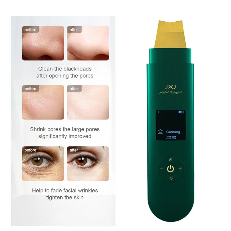

JXJ Ultrasonic Skin Scrubber Deep Face Cleaning Machine Peeling Shovel Facial Pore Cleaner Face Skin Scrubber Lift Machine