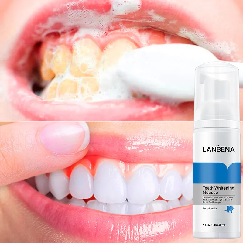 

LANBENA Teeth Whitening Mousse 60ml Whiten Tooth Toothpaste Remove Stain Yellow Tooth Brightening Oral Hygiene Care Dental Tools