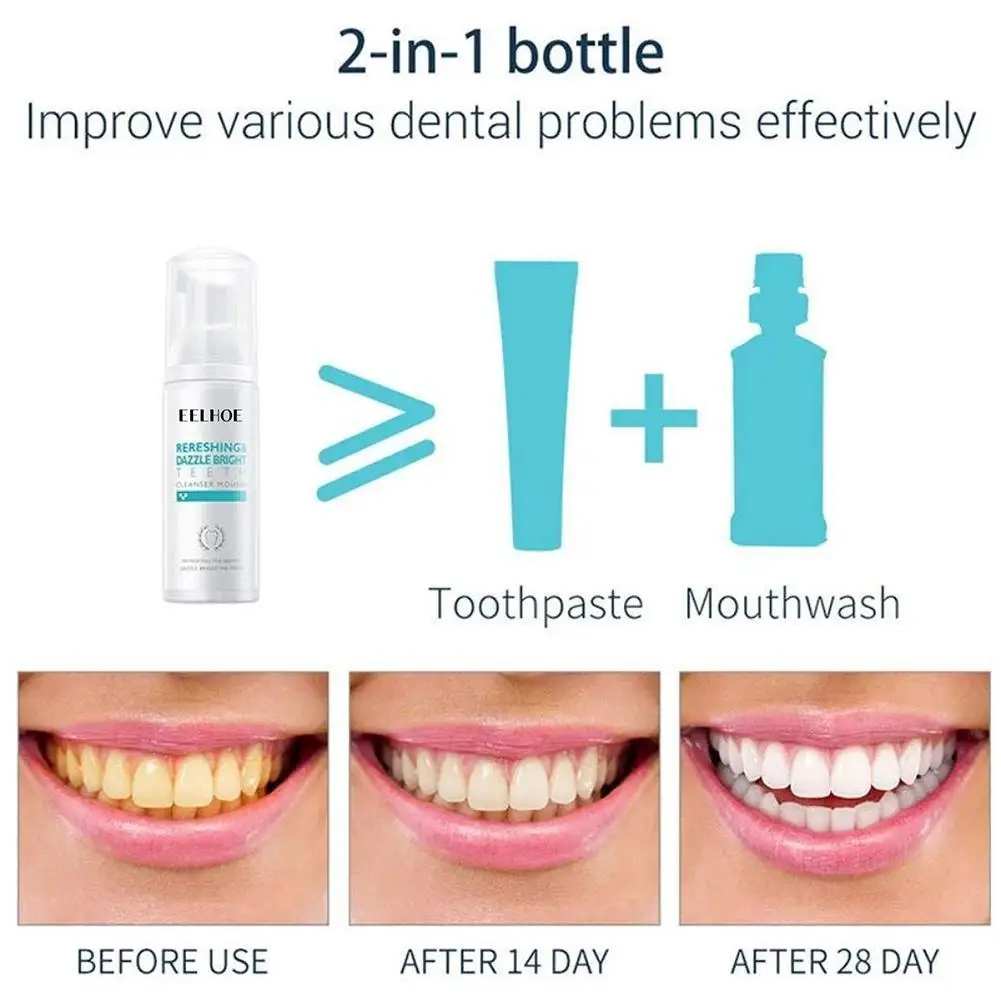 

Care Tooth Whitening Bleach Oral Hygiene Mousse Remove Foam Removes Cleaning Plaque Mouth Stains Toothpaste Stain Product U5Y8