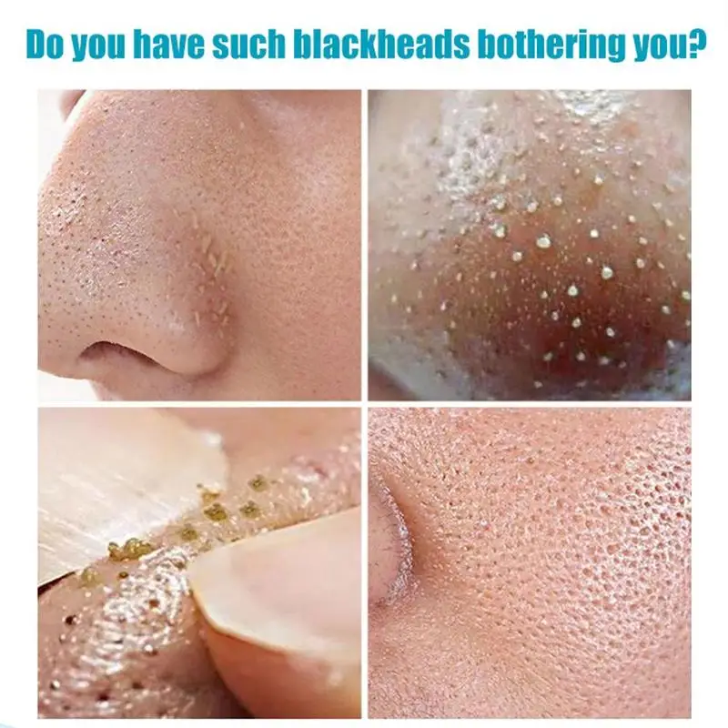 

Green Tea Blackhead Mask Skin Care Remove Acne Nose Care Face Moisturizing Strip Cream Mask Pore Cleansing Whitening Peel D C0P9