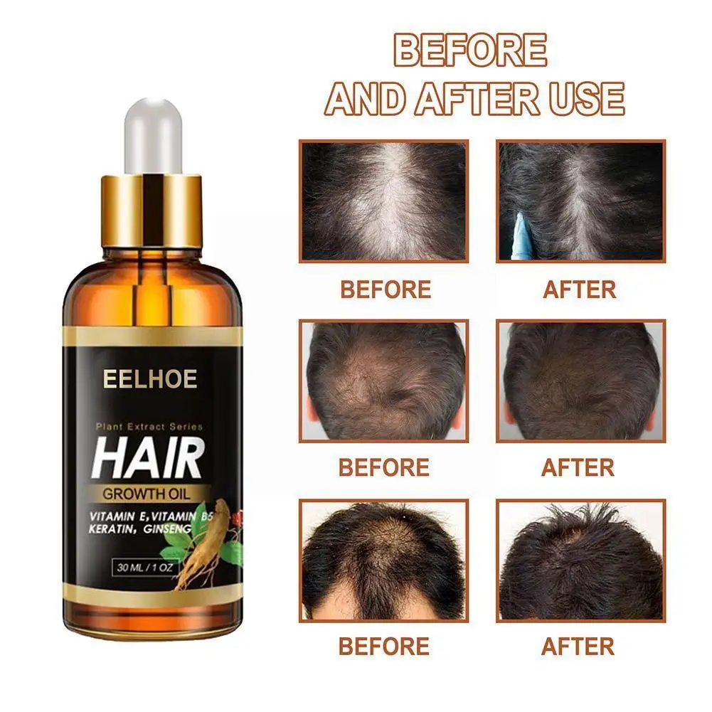 

30ml Hair Growth Essential Oil Hair Loss Treatement Loss Care Essence Anti Hair Fast Hiar Growth Effective Products Growth V9X6