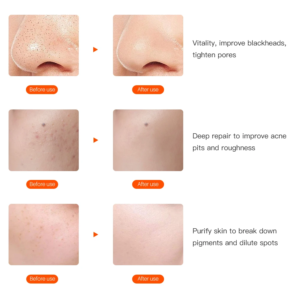 7 цветов светильник светодиодный маска для лица с омоложением кожи шеи уход за