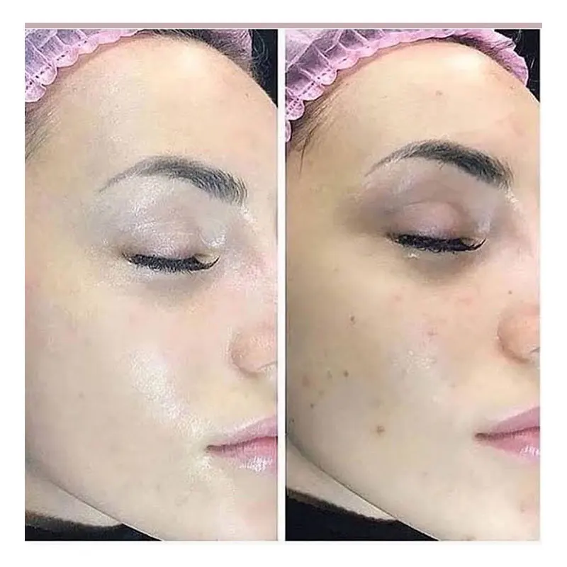 

8ml BB Ampoule Serum Korean Makeup Beauty Foundation Oil-control Brightening Serum Acne lifting Skin Care BB Concealer BB Cream