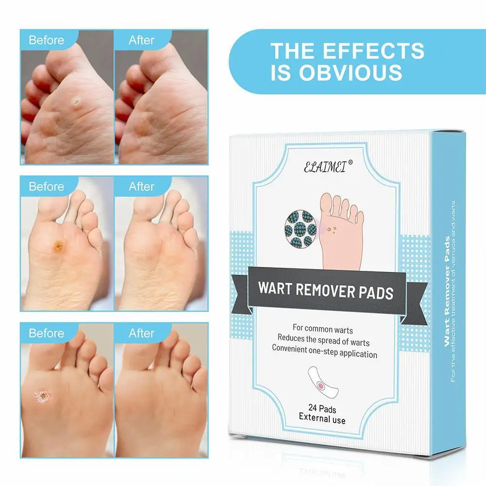 

Elaimei Corn Stick Foot Patch Relieve Pain 24 Pieces Exfoliating Dead Skin Socks Pedicure Care Of Remover Peeling Foot Foot P5S1