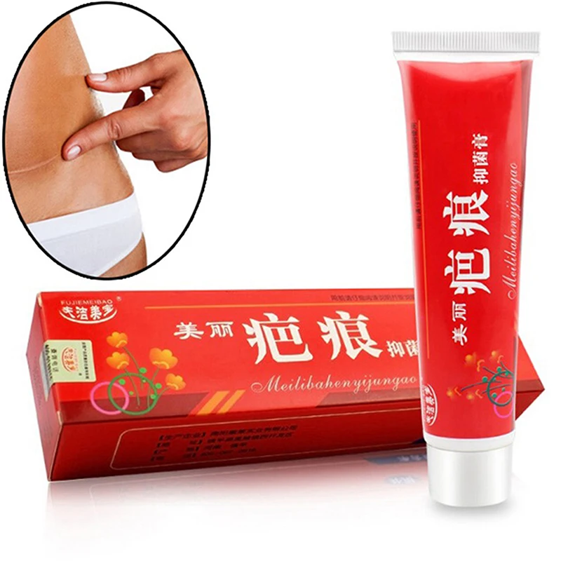 

Acne Scar Removal Cream Pimples Stretch Marks Face Gel Remove Acne Skin Care