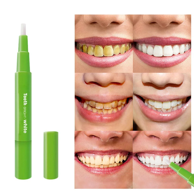 2019 Горячая продажа отбеливание зубов ручка эффективная безболезненная без