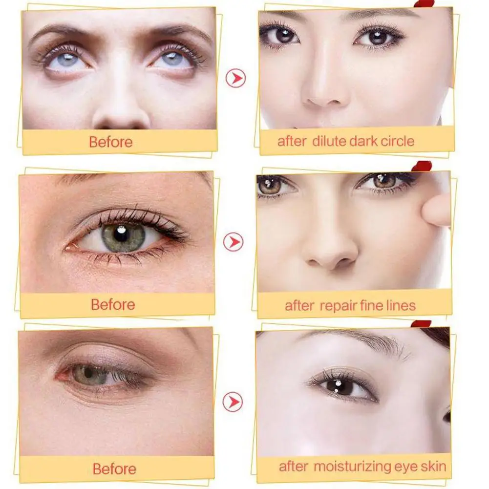 

10 Pairs Eye Mask For Dark Circles Puffiness Eye Bags Patches Anti-Wrinkle Care Eye Removal Fine Skin Lines Moisturizing O6P2