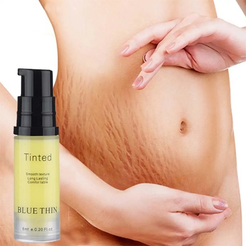 Натуральный Крем-растяжка с витамином е для восстановления шрамов во время