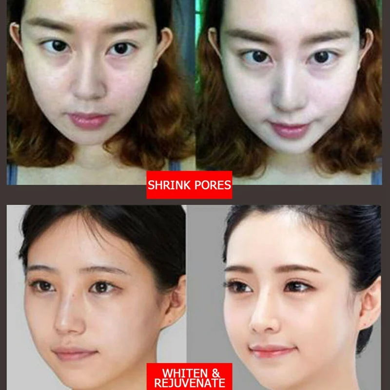 Профессиональный электрический гидро Мезотерапия пистолет инжектор воды Дерма