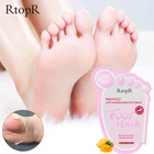 1 сумка Mango Foot коллагеновая маска мертвого отбеливание увлажняющий, отшелушивающий обновления педикюр удалить омертвевшие чешуйки кожи каблук носки для пилинга, ухаживает за кожей стоп